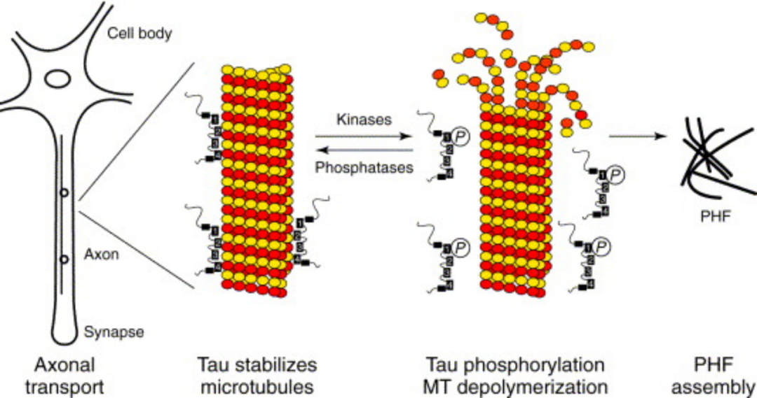 阿尔茨海默症药物研发，Aβ、Tau、免疫、基因疗法百花齐放